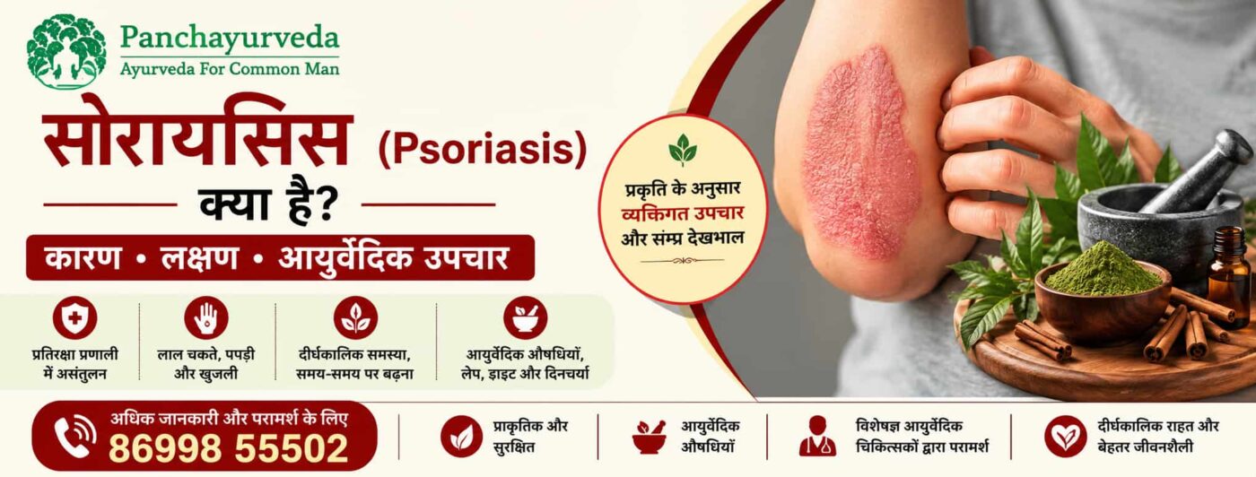 Psoriasis Ayurvedic Treatment